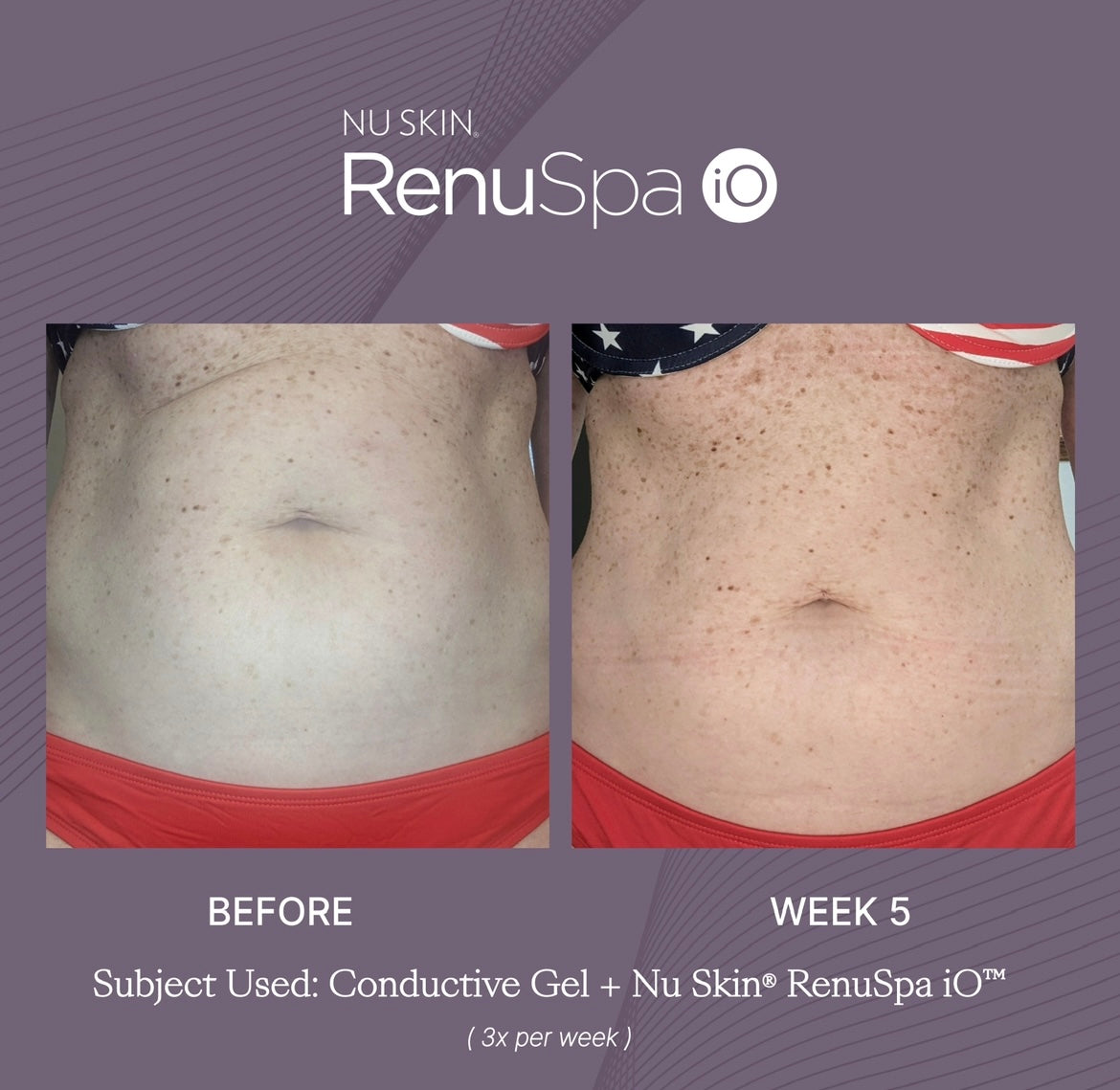 Nu Skin® RenuSpa iO