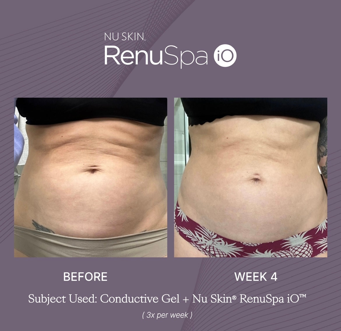 Nu Skin® RenuSpa iO