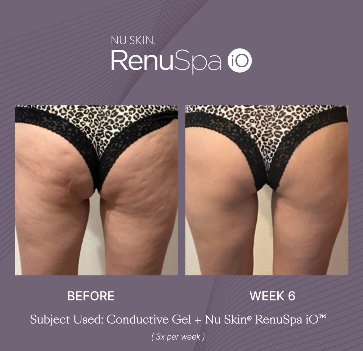 Nu Skin® RenuSpa iO